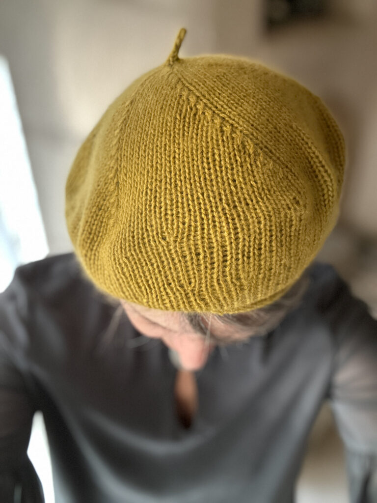 Gorgeous yarn!